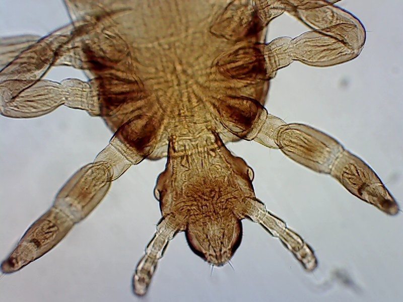 Closeup photo of head louse