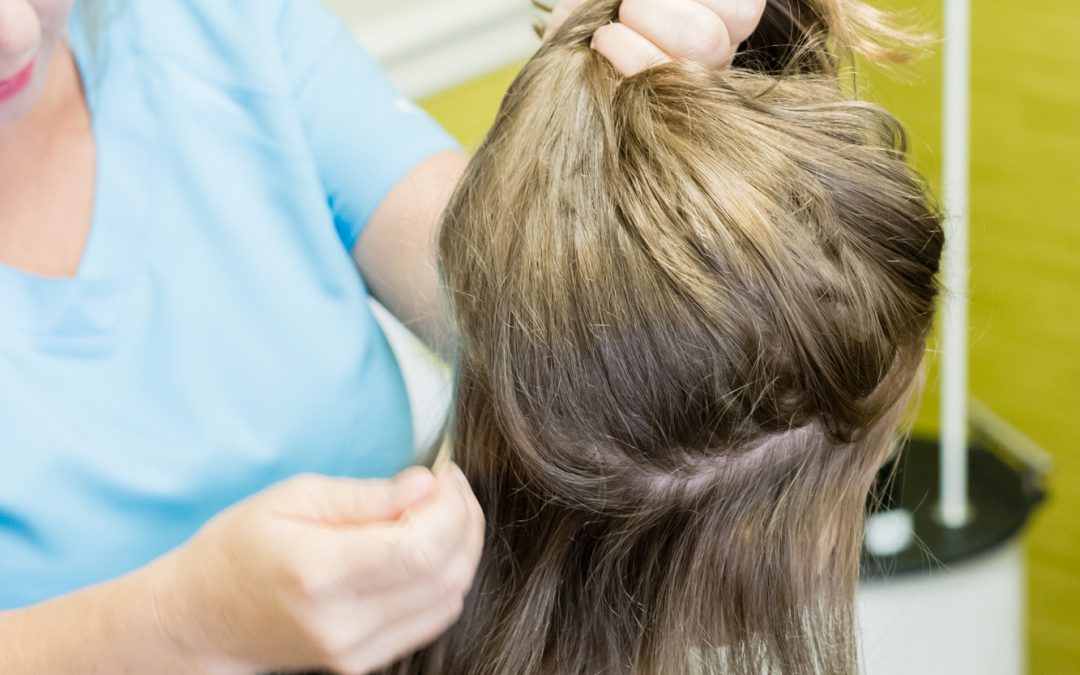 Got Head Lice? Here Are Some Signs to Look For