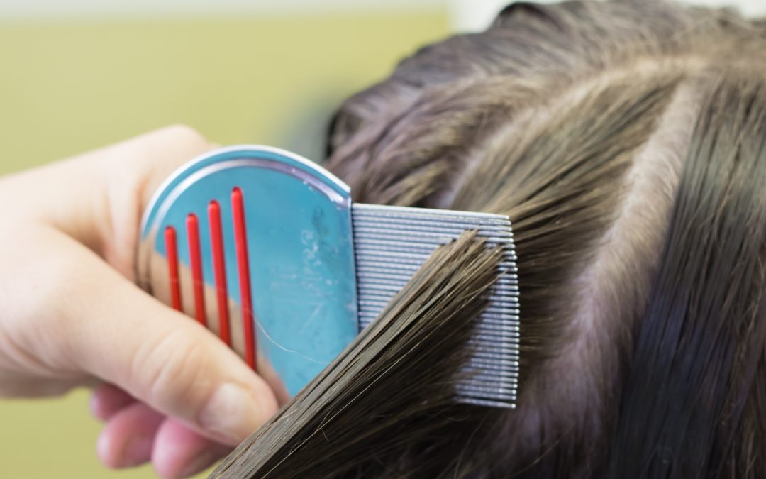 How to get rid of head lice in long hair 5 Common Myths Associated With Head Lice