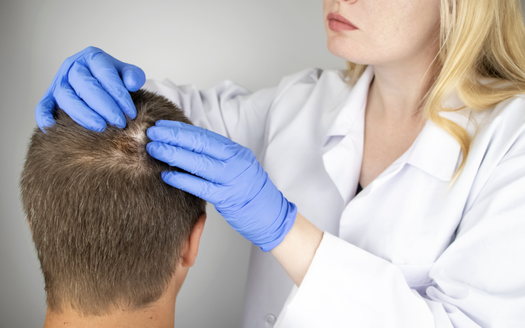 What are those bumps on my scalp? Top 5 Head Sore Causes