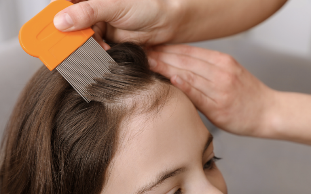 Is Spotting Lice Harder Based on Hair Color?
